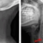 Group logo of Neck Surgery Edison