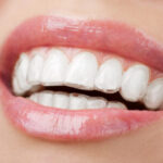Group logo of Recovery and Aftercare for Dental Implants, Teeth Straightening, and Jaw Surgery